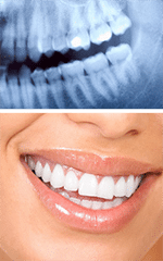 Dental Radiography and X-Ray Services